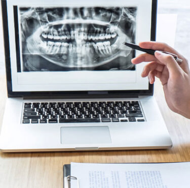 Does-My-Child-Really-Need-X-rays-Taken-at-the-Dentist