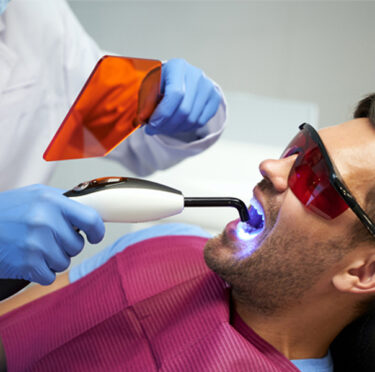 Blog: The Art of Tooth Restoration: A Closer Look at Dental Fillings